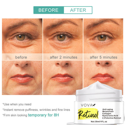 Retinol Anti-Aging Moisturizer